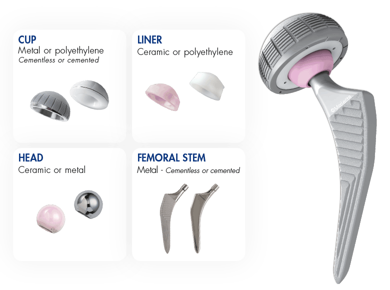 Hip Replacement Surgery