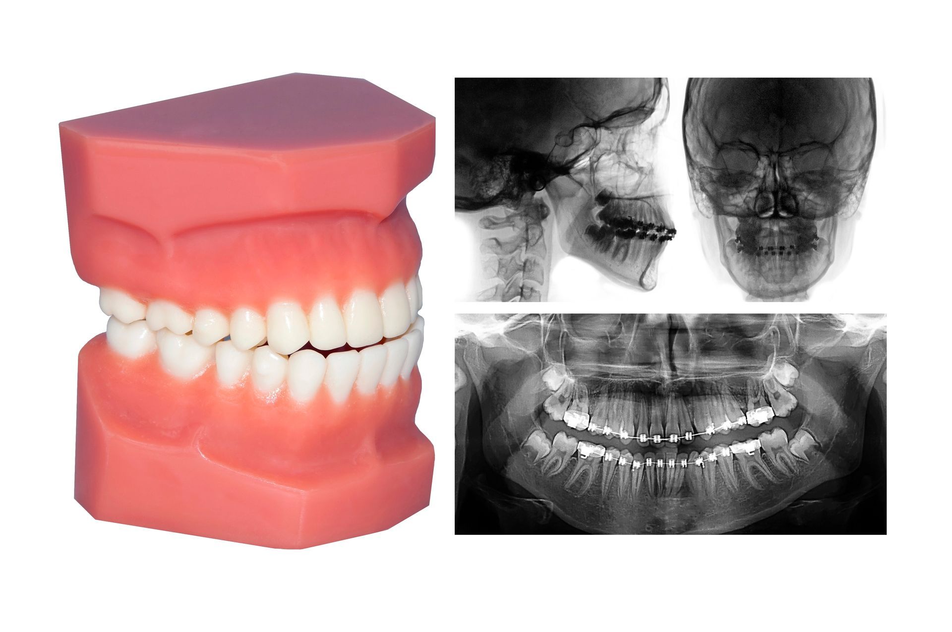 dentures