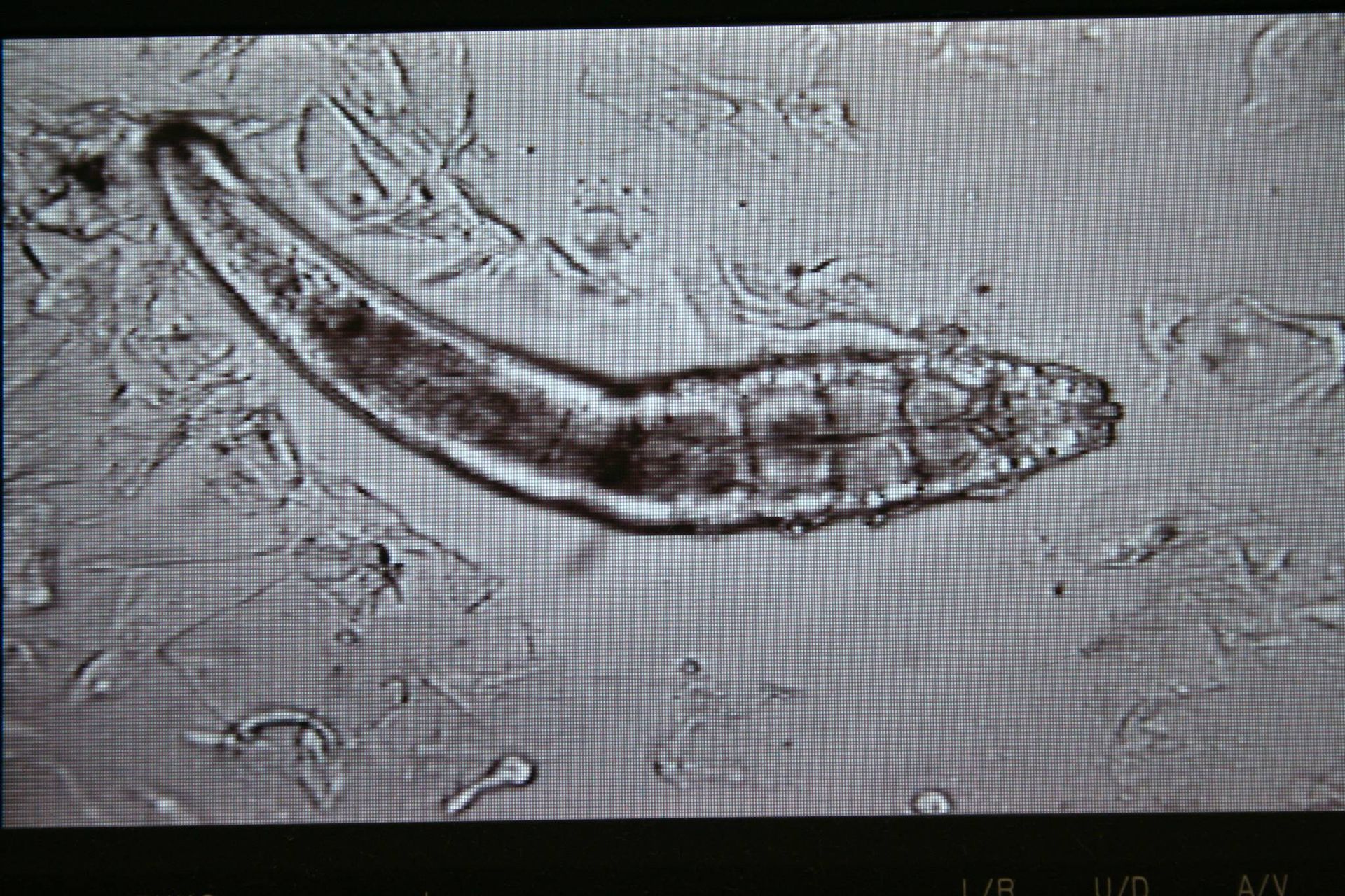 Microscopic View of An Elongated Translucent Worm-Like Organism — Sarina Veterinary Surgery In Sarina, QLD