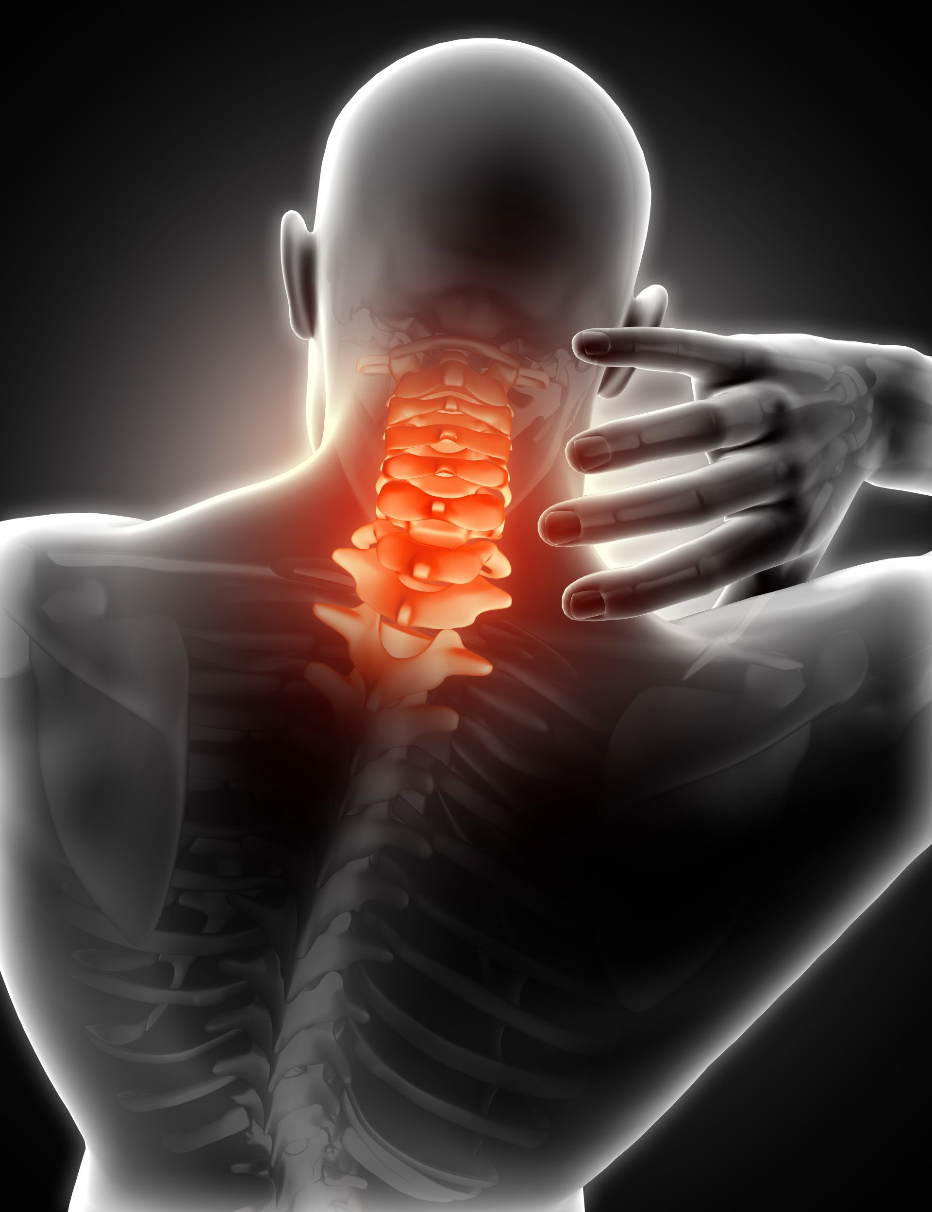 Como diagnosticar queimação na cervical Como diagnosticar queimação na cervical