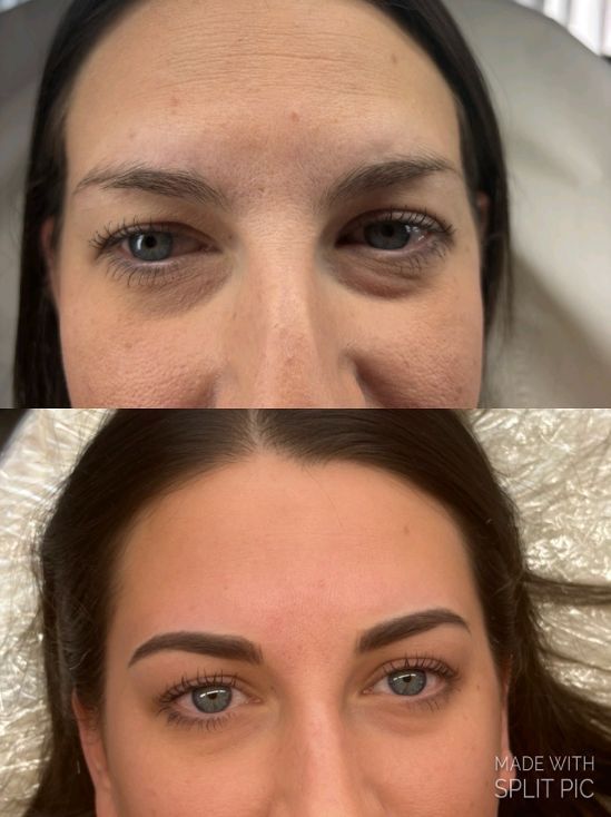 SPMU Treatment | Flawless Beauty by Jodie
