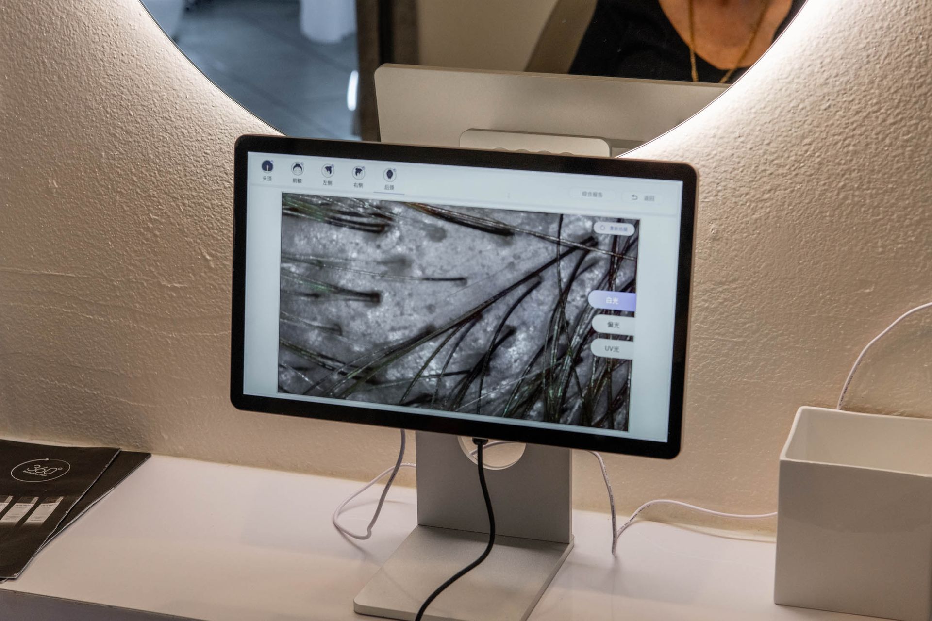 A computer monitor on a desk displays a magnified, grayscale microscopic image of hair follicles and scalp skin.