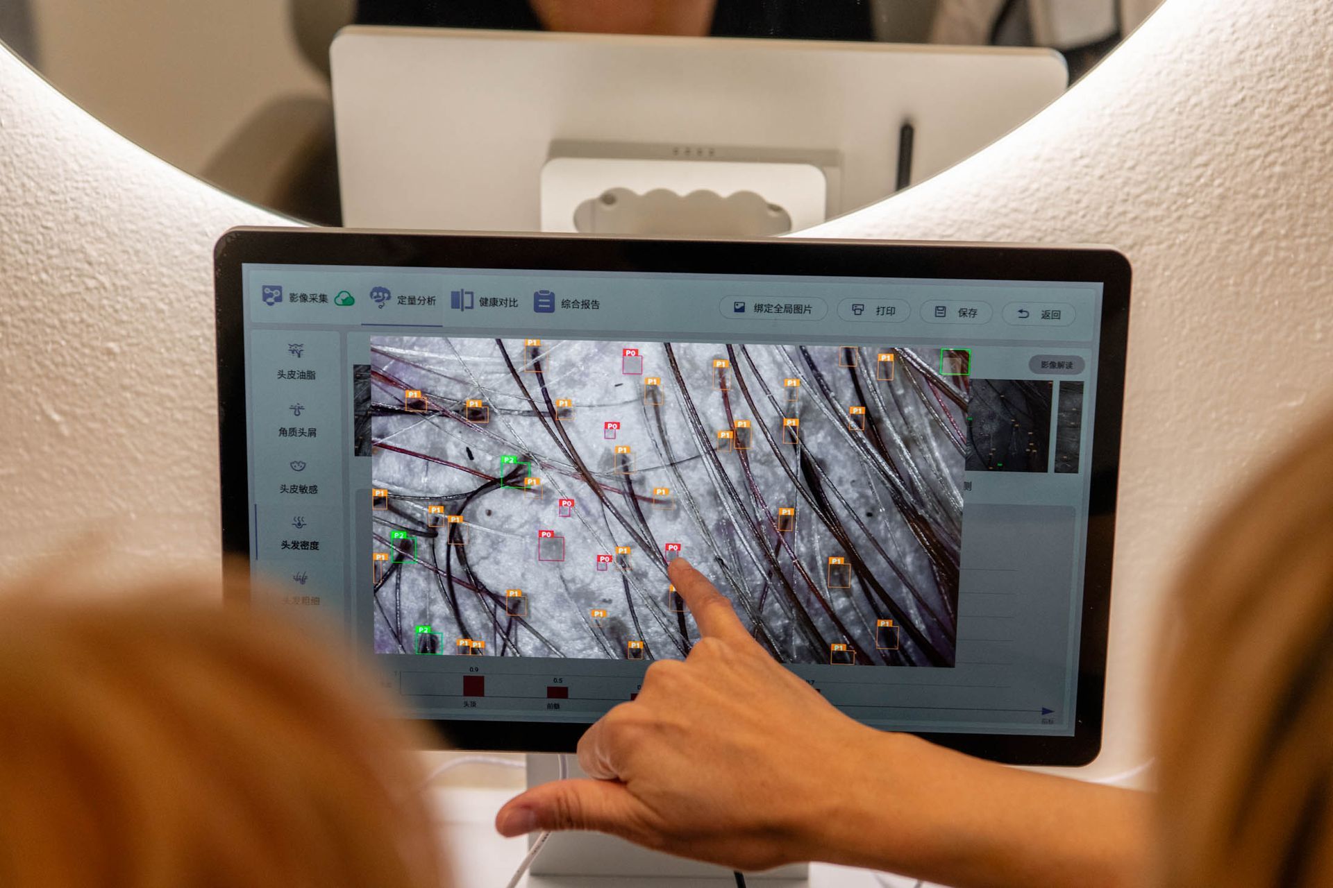 A hand points to a digital screen showing a magnified view of a scalp with hair follicles being analyzed by software.