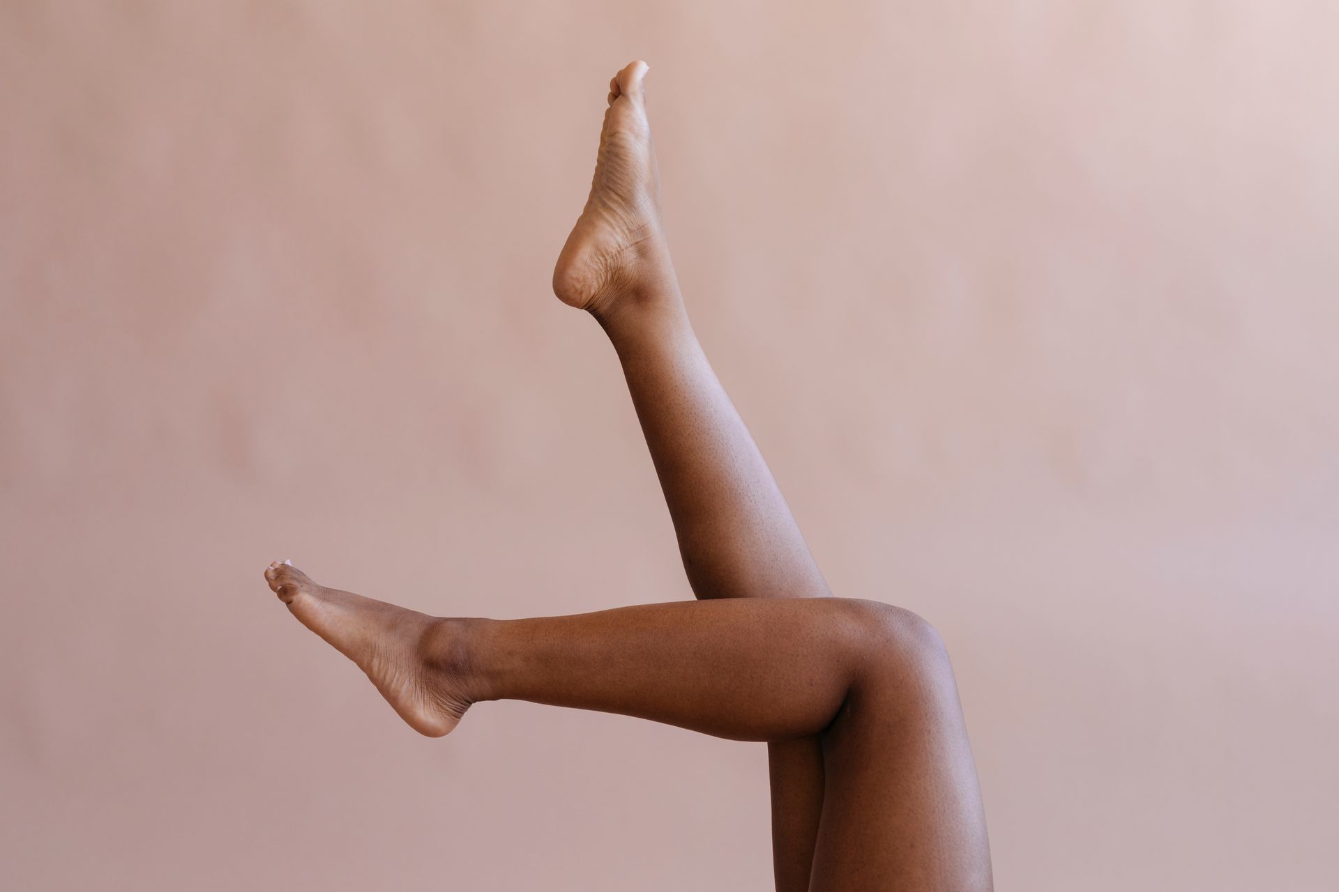 Escleroterapia com Glicose
