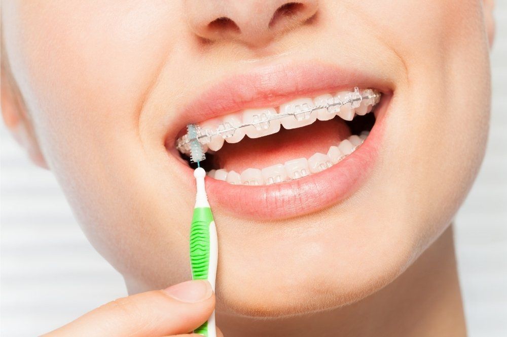 Cura delle Carie: Studio Dentistico Vecchiotti Cesena Ortodonzia: Studio Dentistico Vecchiotti Cesena 0547 24741