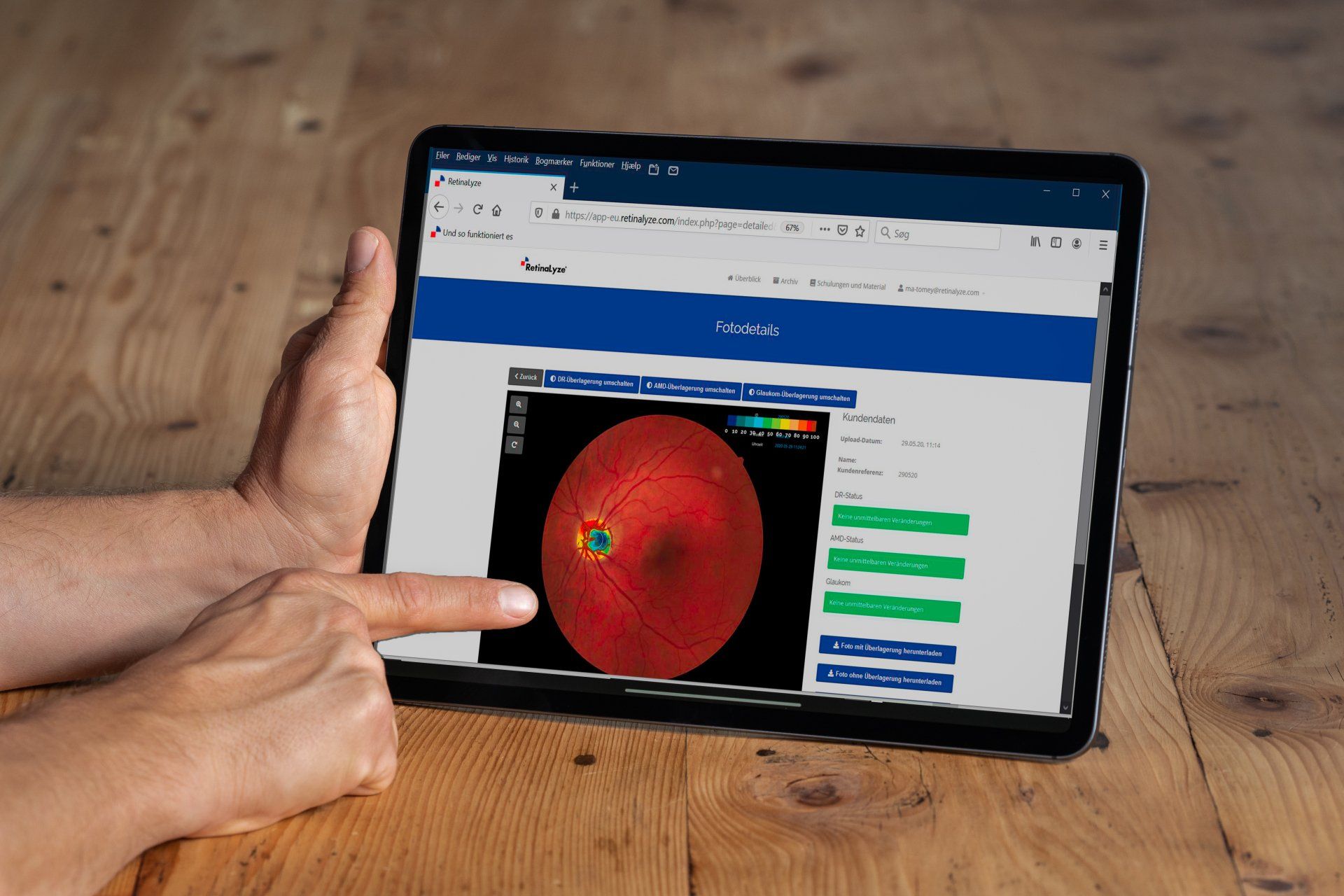 Die Retinalyze ®-Software kann auch auf Tabletts genutzt werden. Die Retinalyze ®-Software kann auch auf Tabletts genutzt werden.