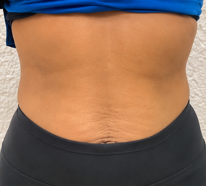Close-up of a bare midsection with a blue top and black waistband against a plain background
