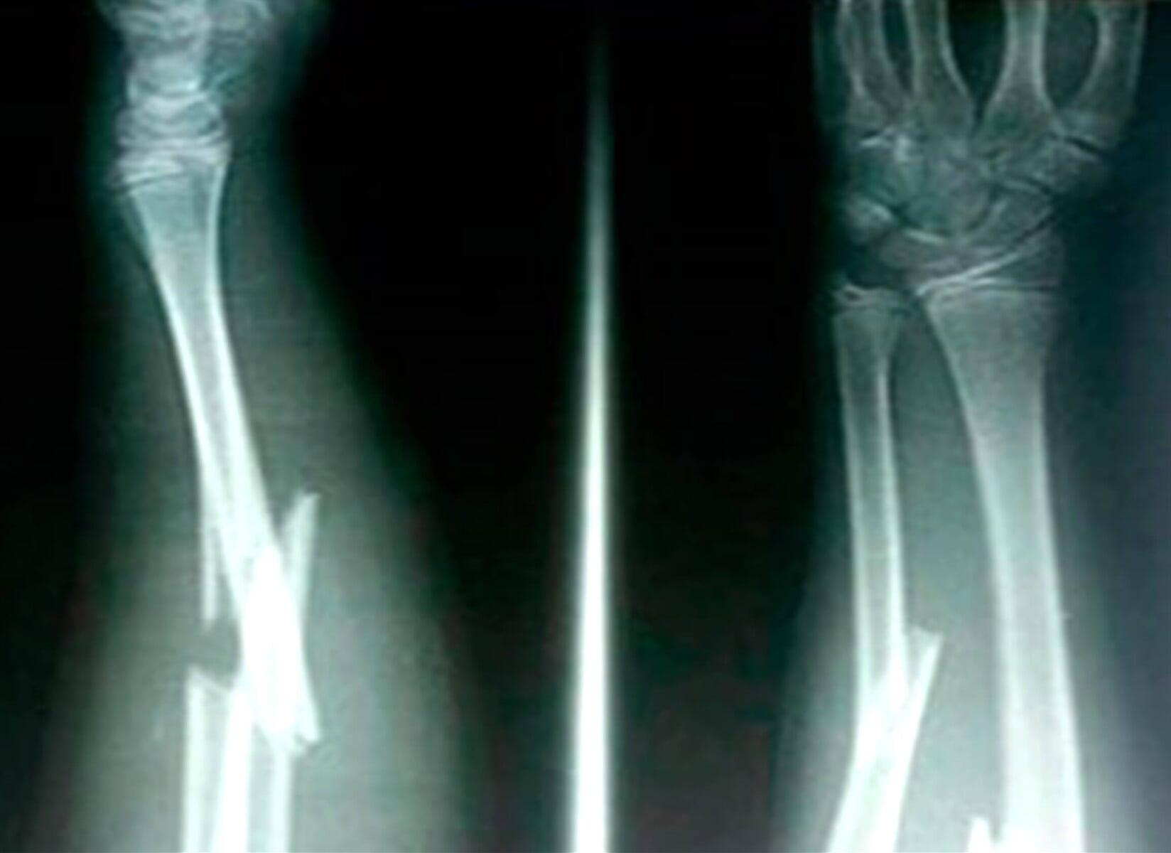 SANATORIO QUIROZ - TRAUMATOLOGÍA