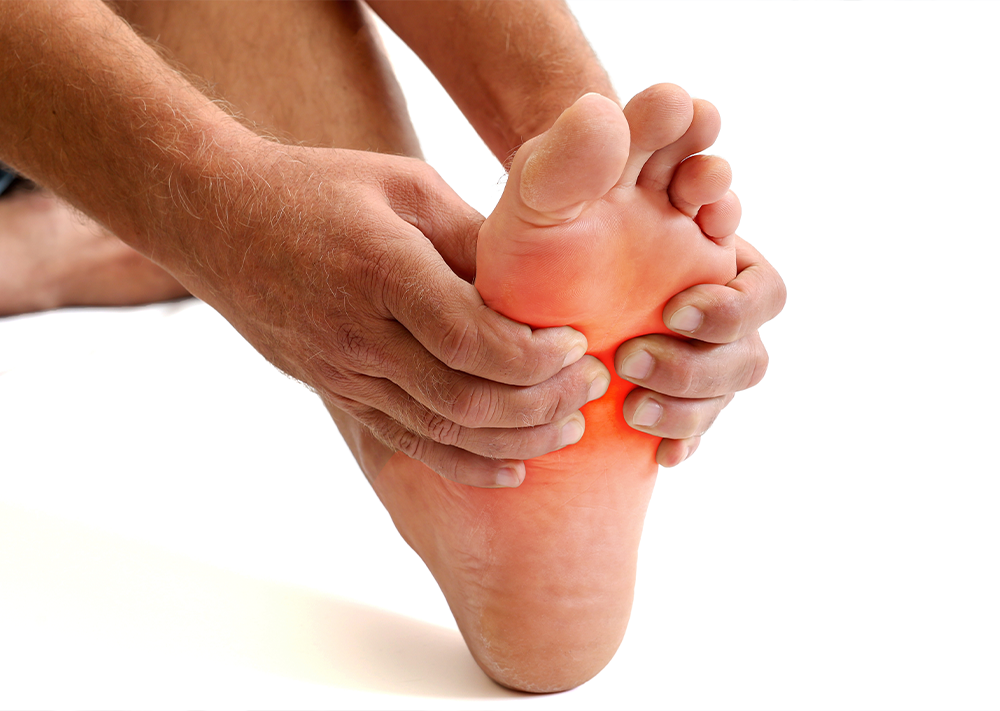 Arch Pain