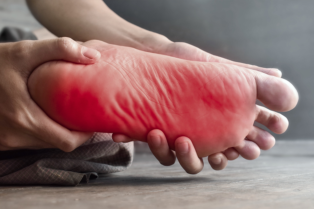 Erythromelalgia
