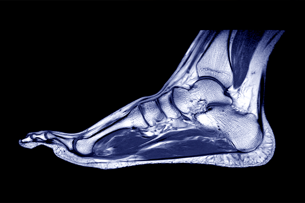 MRI
