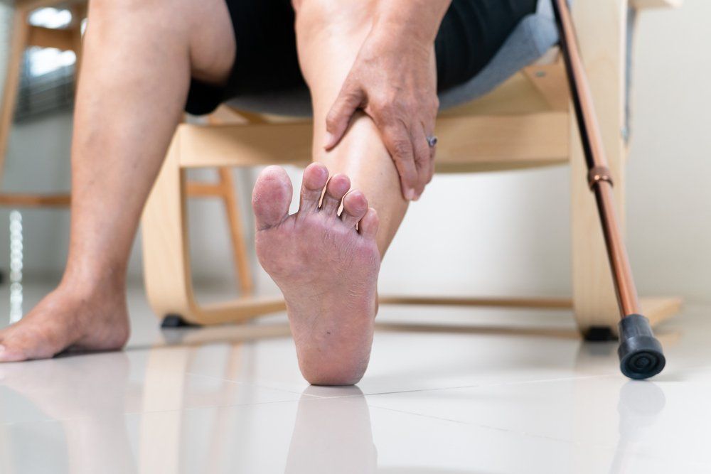 Dry Skin And Cornea On Senior Woman Foot — Podiatry In Forster, NSW