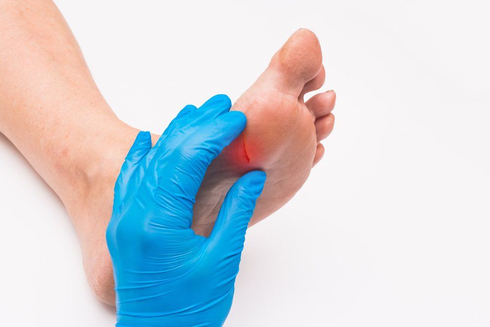 Doctor Using Protective Medical Glove While Examining The Wound On The Foot  — Podiatry In Forster, NSW