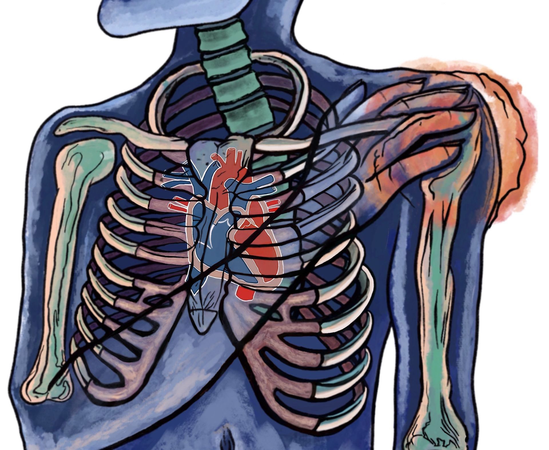 shoulder pain