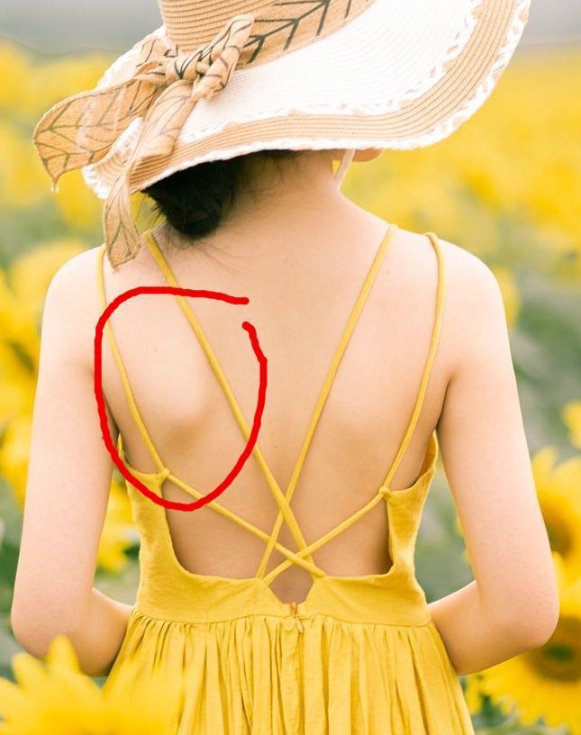 shoulder muscle pain
