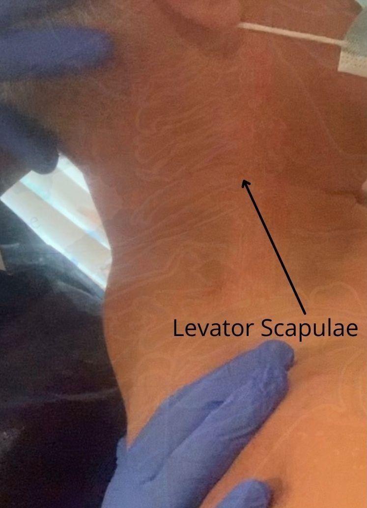 neck anatomy