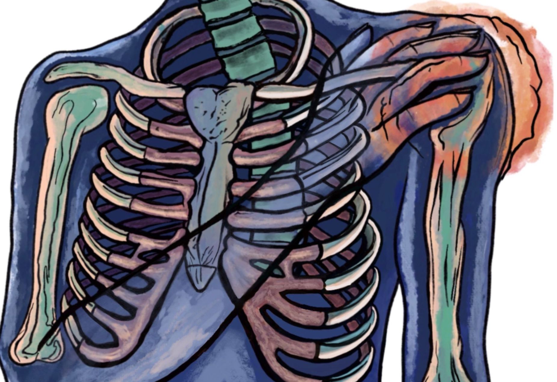 Person showing shoulder pain due to frozen shoulder