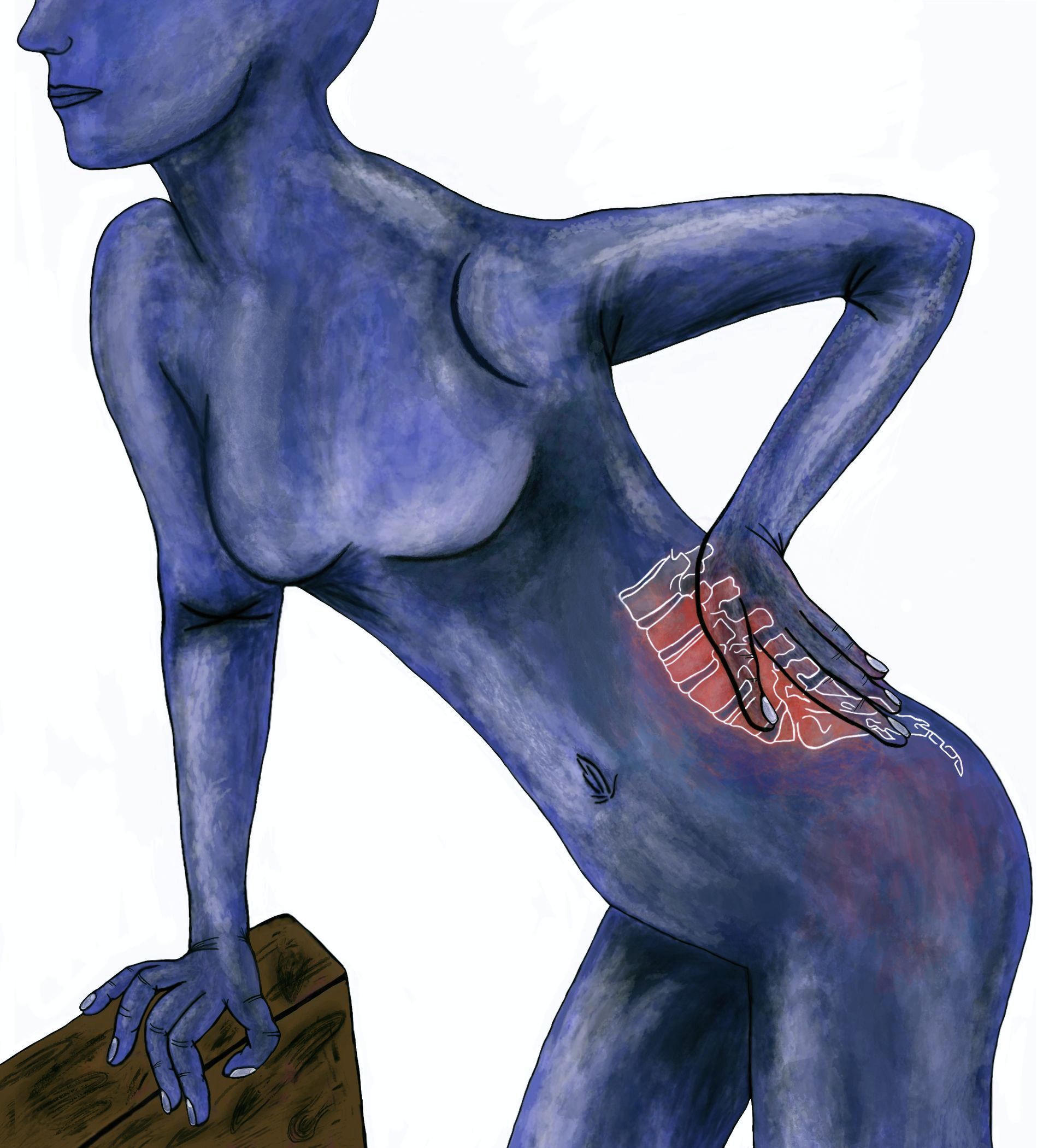 Woman with lower back pain