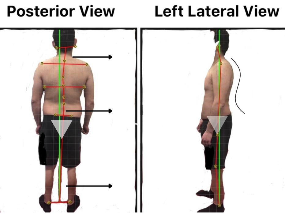 posture screen 