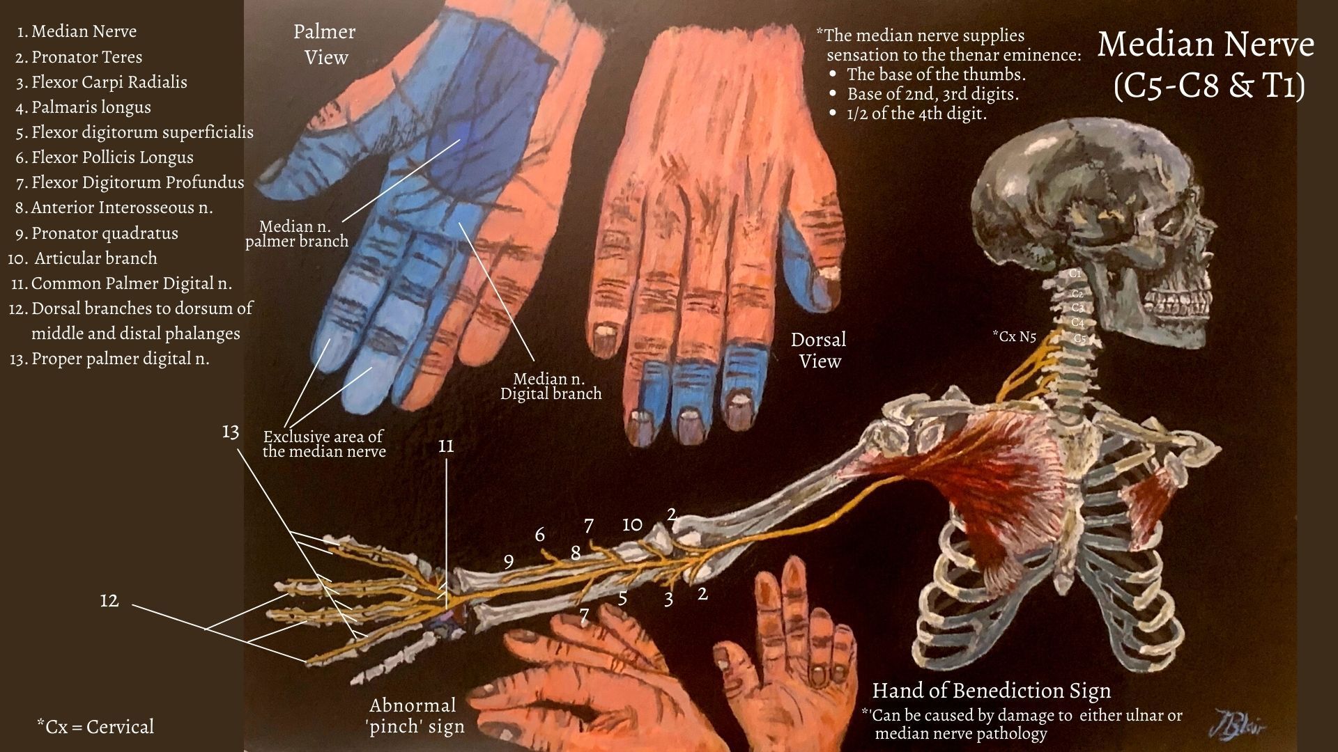 median nerve entrapment