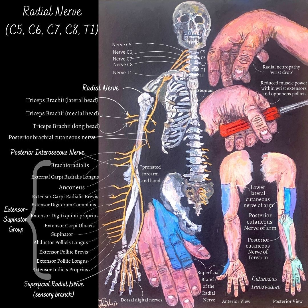 Radial nerve neuropathy and trapped nerve