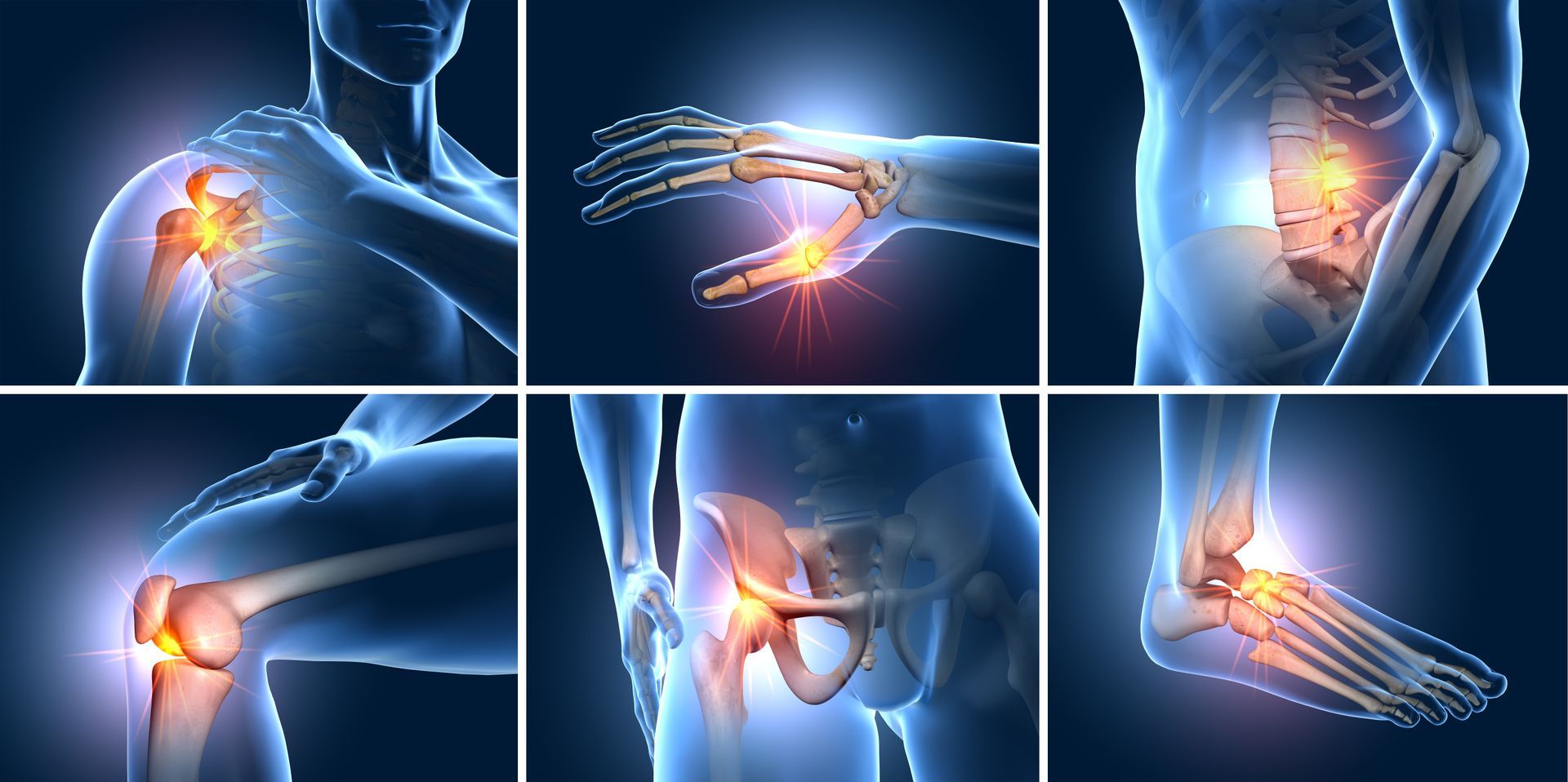 Osteoarthritis in joints