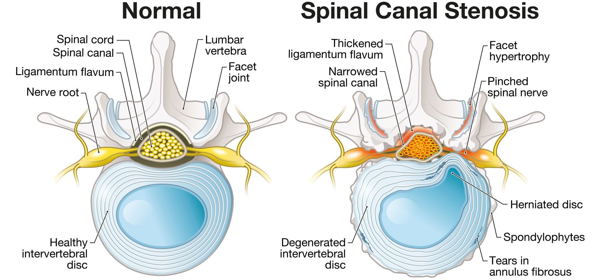 vertebrae of spine anatomy
