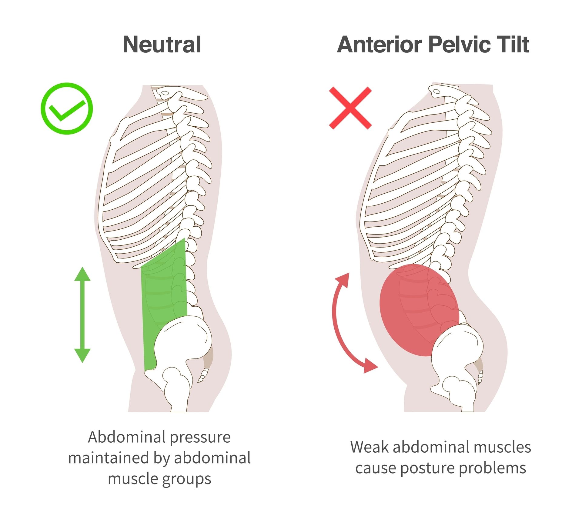pelvic position