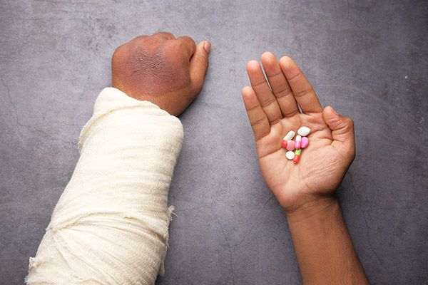 Two hands on a gray surface, one in a white cast, the other holding colorful pills.