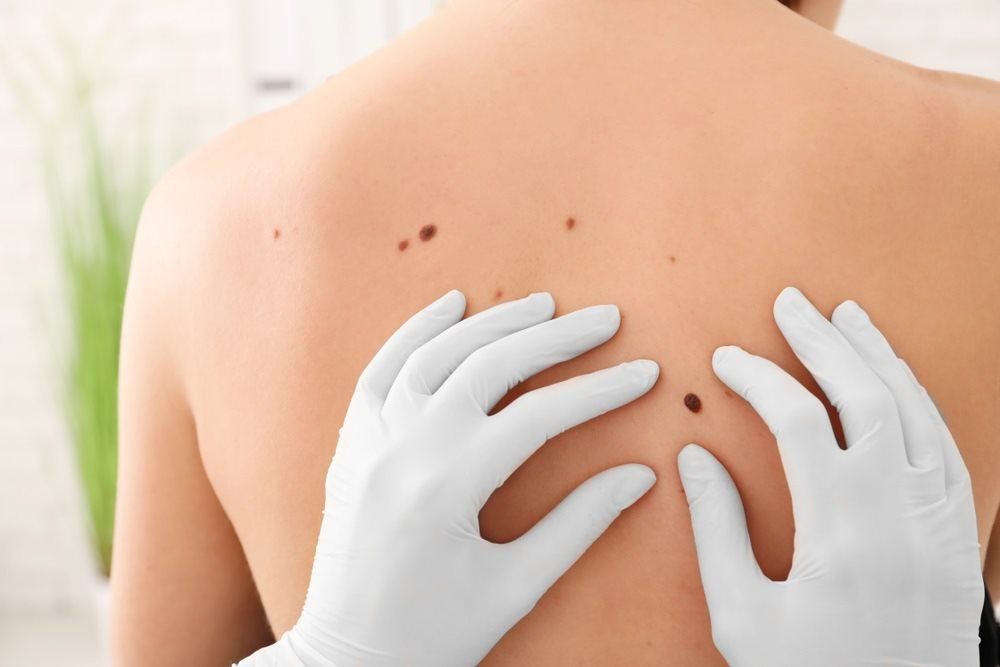 Skin Test — Endoscopist & General Surgeon in Mackay, QLD