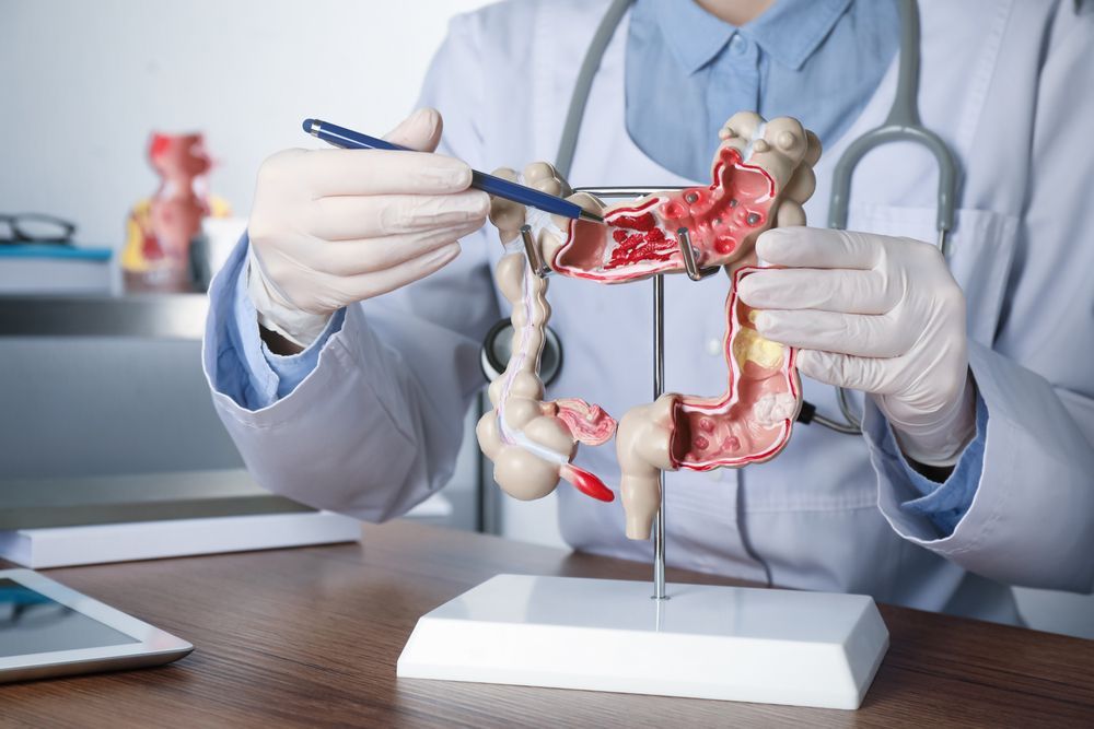 Doctor Holding Human Colon Model — Endoscopist & General Surgeon in Mackay, QLD