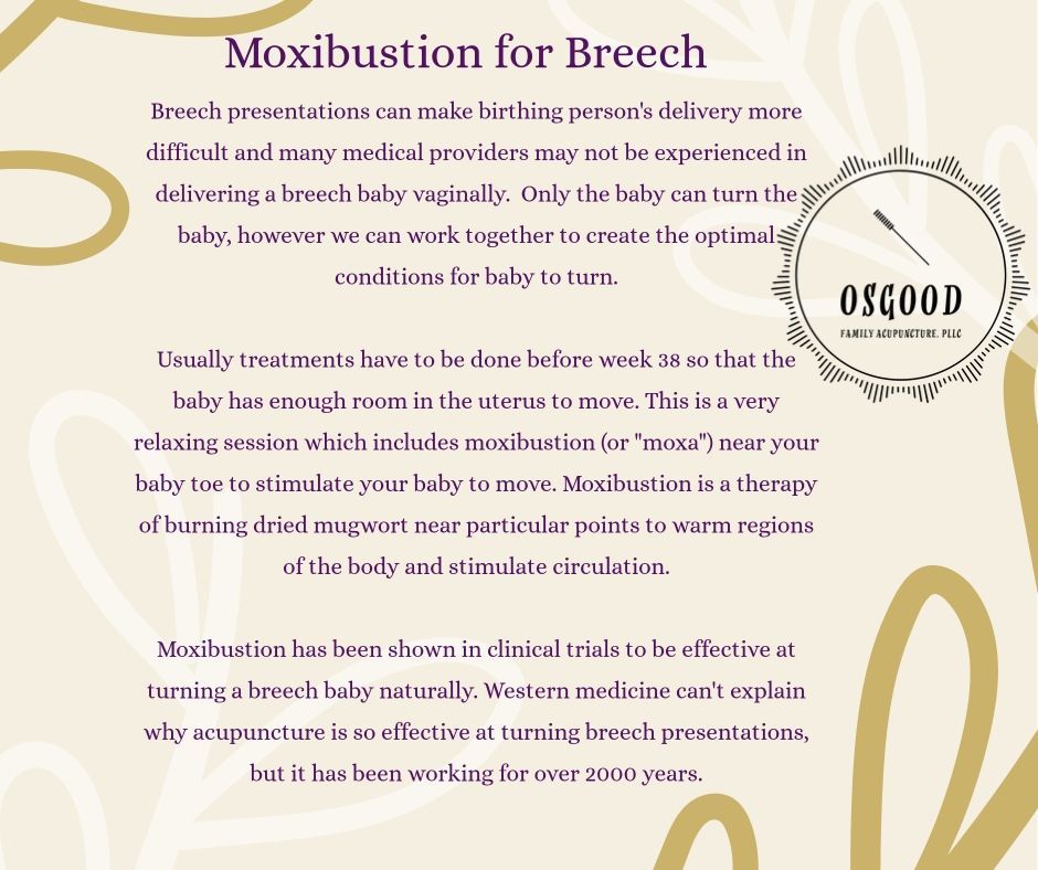 Informational graphic about moxibustion for breech babies. Text on a tan background with logo in upper right corner.