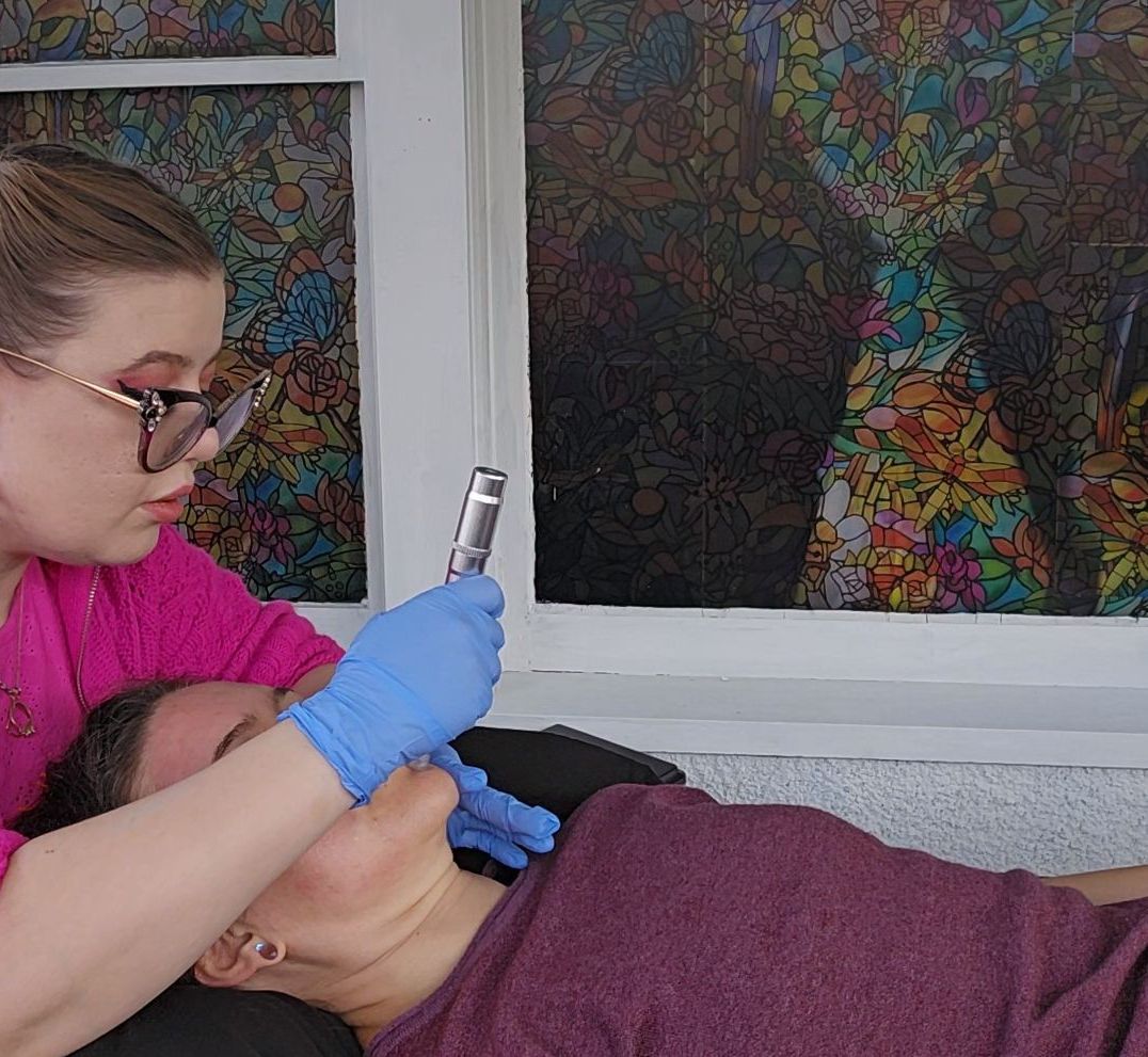 A woman in blue gloves performs facial microneedling. Sunlight through a stained glass window.