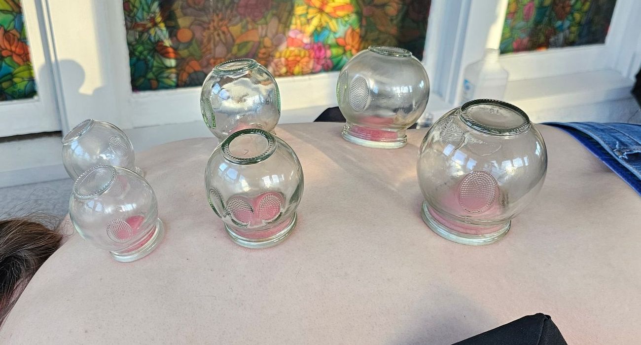 Clear glass cupping therapy cups on a pink surface, with colorful framed artwork in the background.