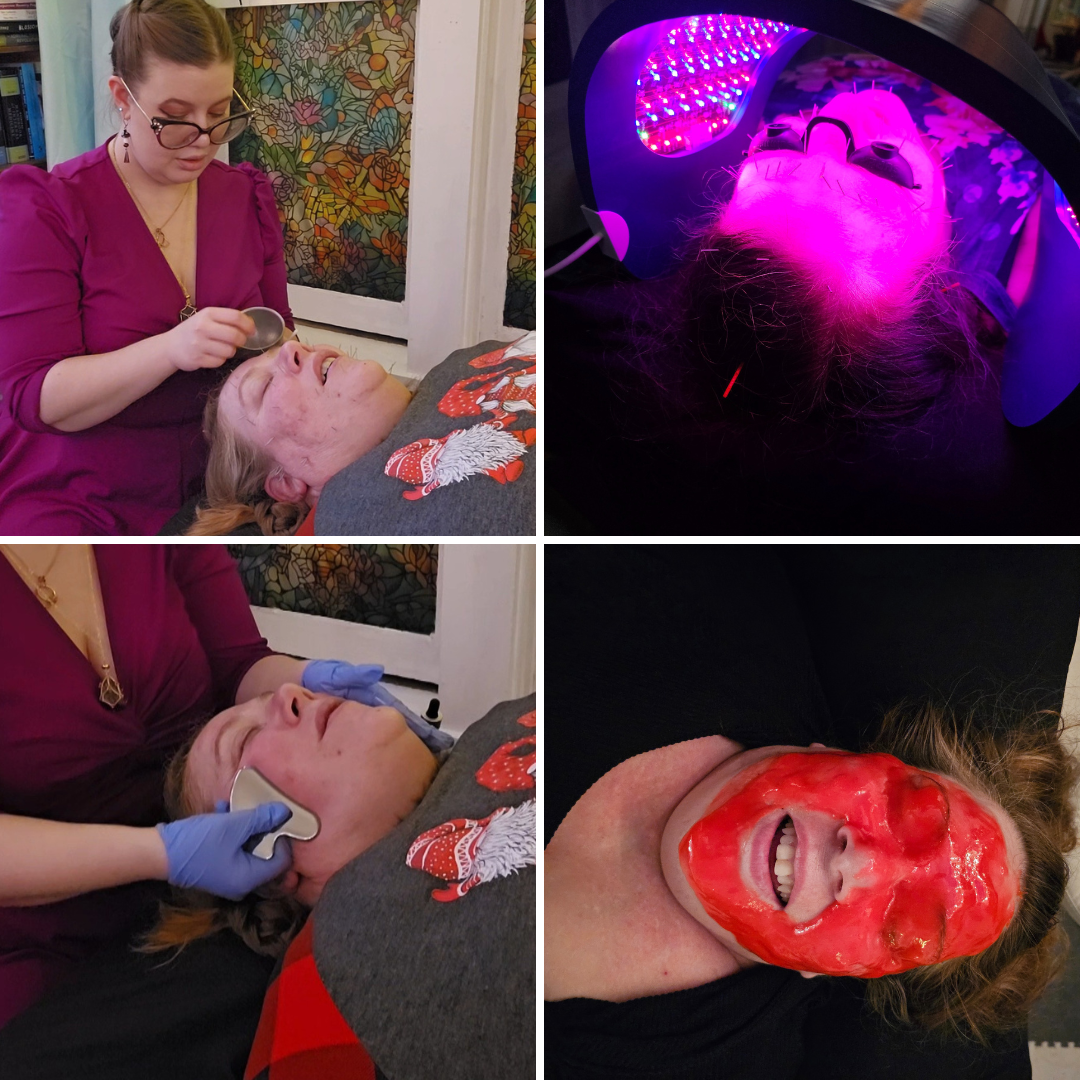 Acupuncture Glow facial including acupuncture, celluma, gua sha & hydrojelly mask
