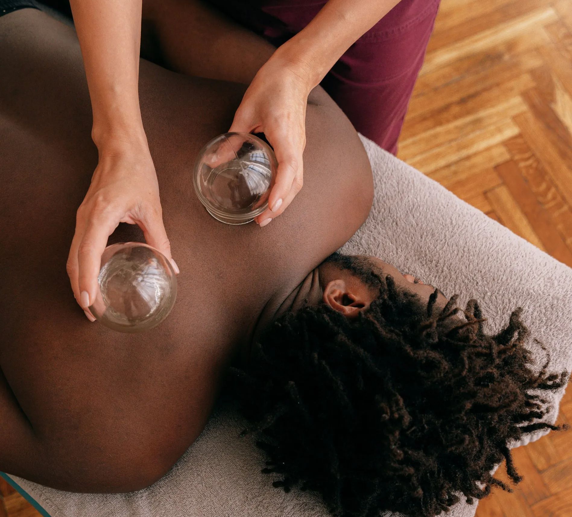 Person receiving cupping therapy on their back; therapist holds two glass cups; close-up.
