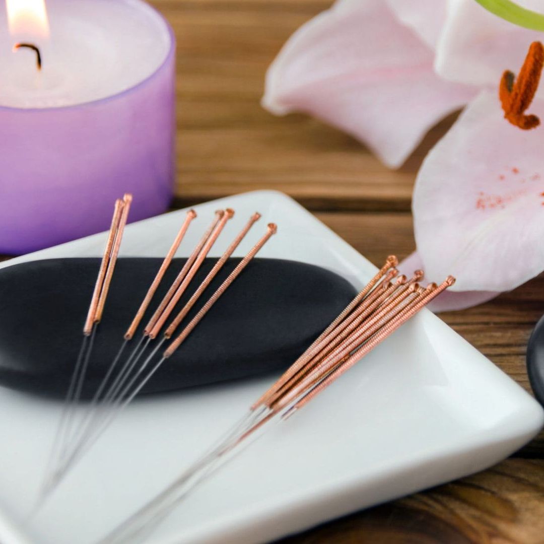 ACUPUNCTURE