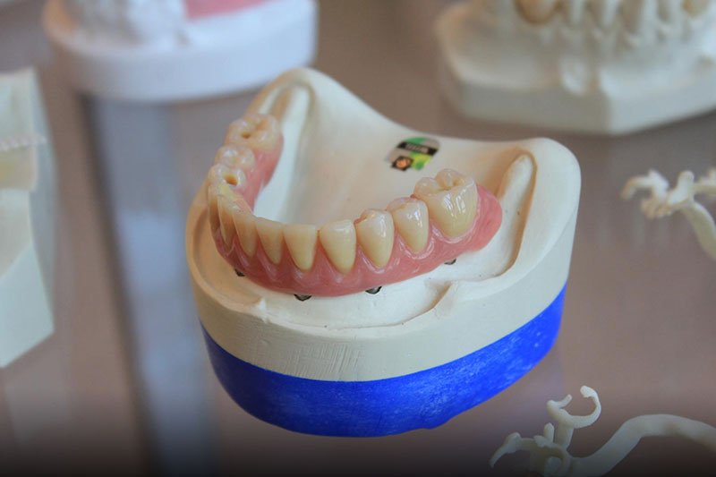 Sarasota Dentist Affordable Dentist in Sarasota, FL