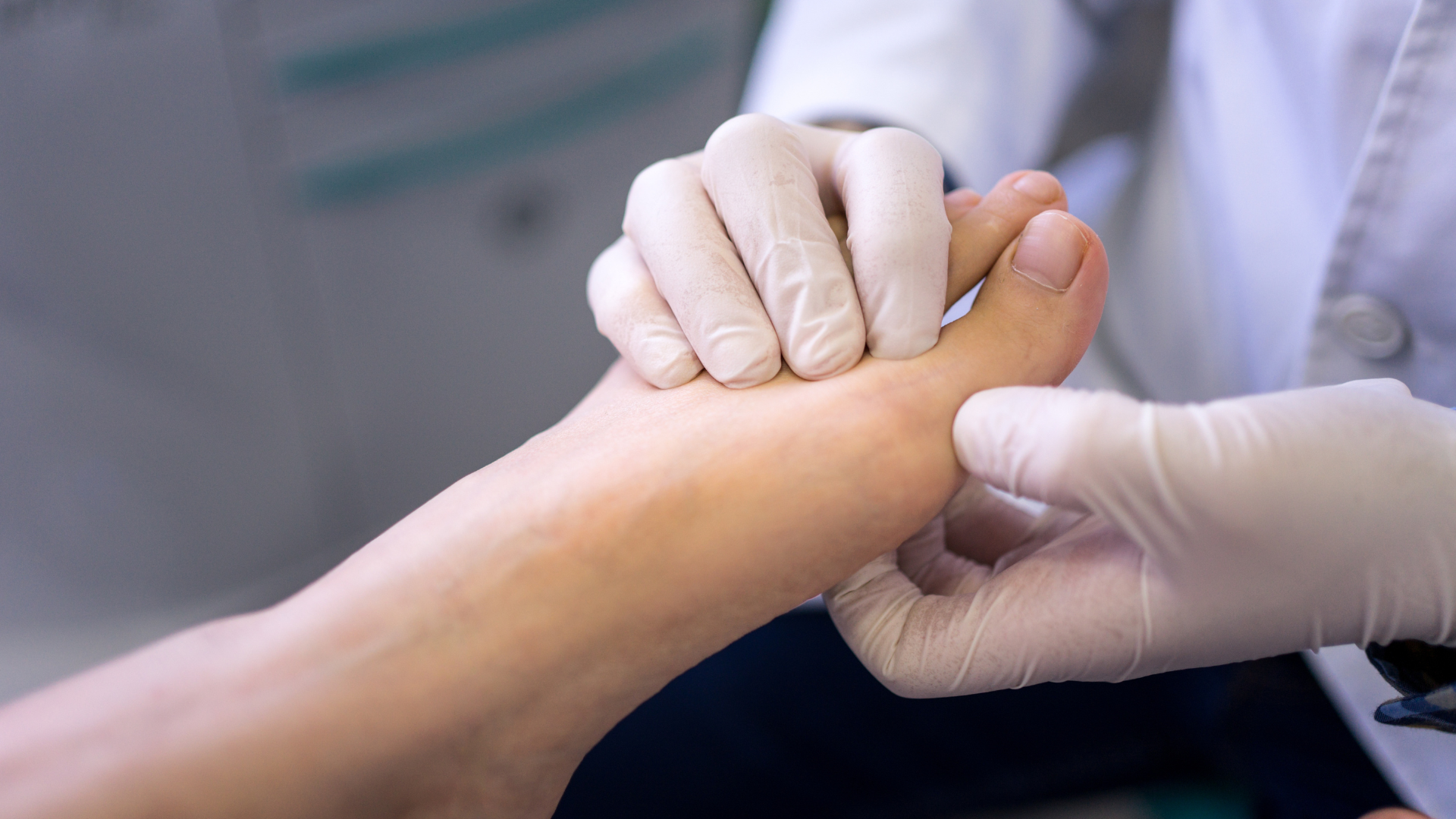 A person's foot being examined by a gloved hand, likely in a medical setting.