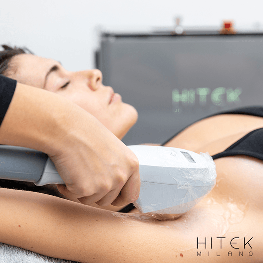 Persona sottoposta a trattamento di epilazione laser delle ascelle presso Hitek Milano.