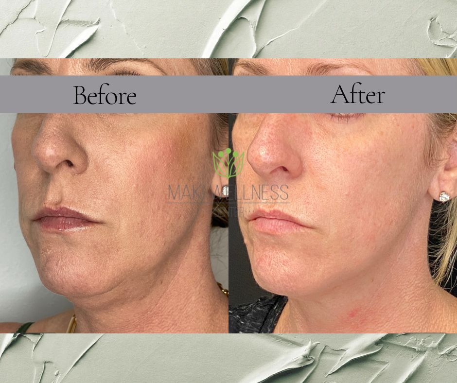 A before and after photo of a woman 's face
