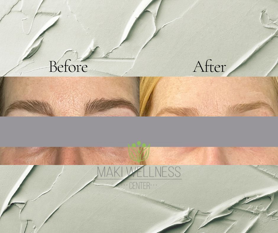 A before and after photo of a woman 's face