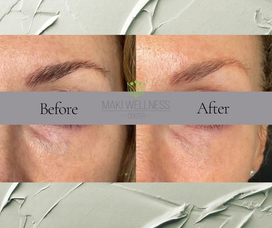A before and after photo of a woman 's eyebrows