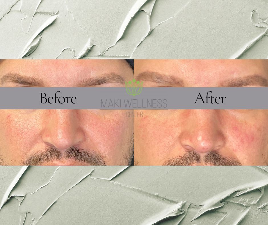 A before and after photo of a man 's face