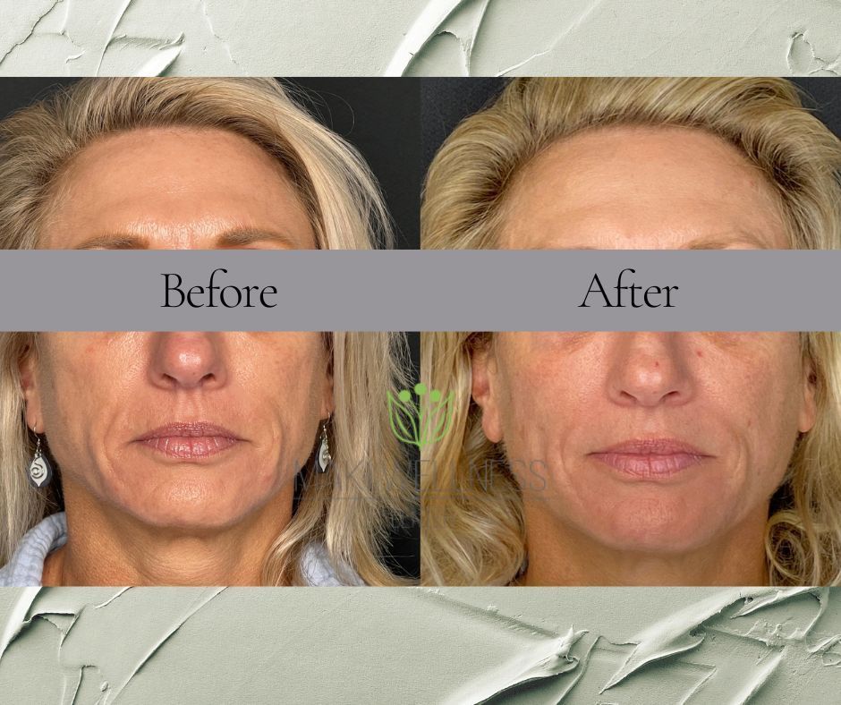 A before and after photo of a woman 's face