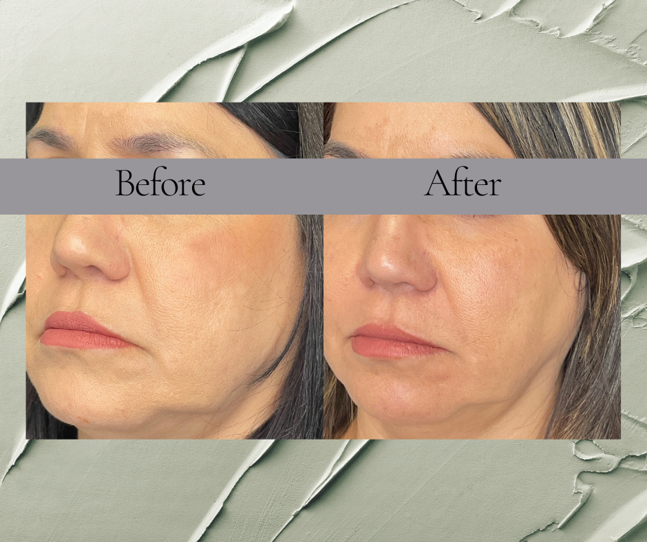A before and after photo of a woman 's face