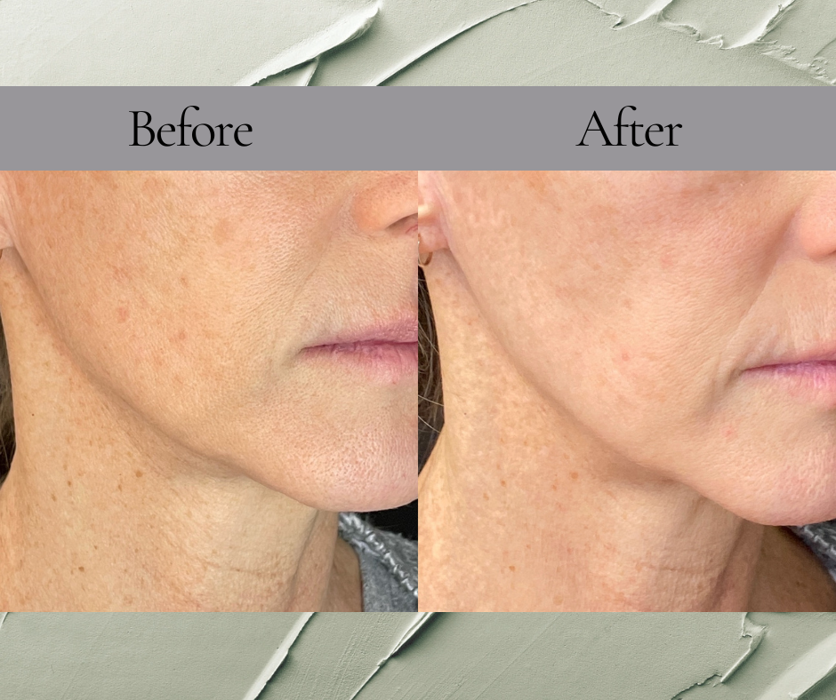A before and after photo of a woman 's face