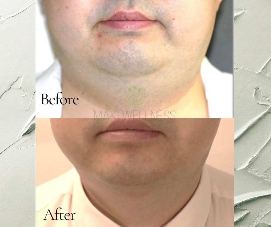 A before and after photo of a man 's face
