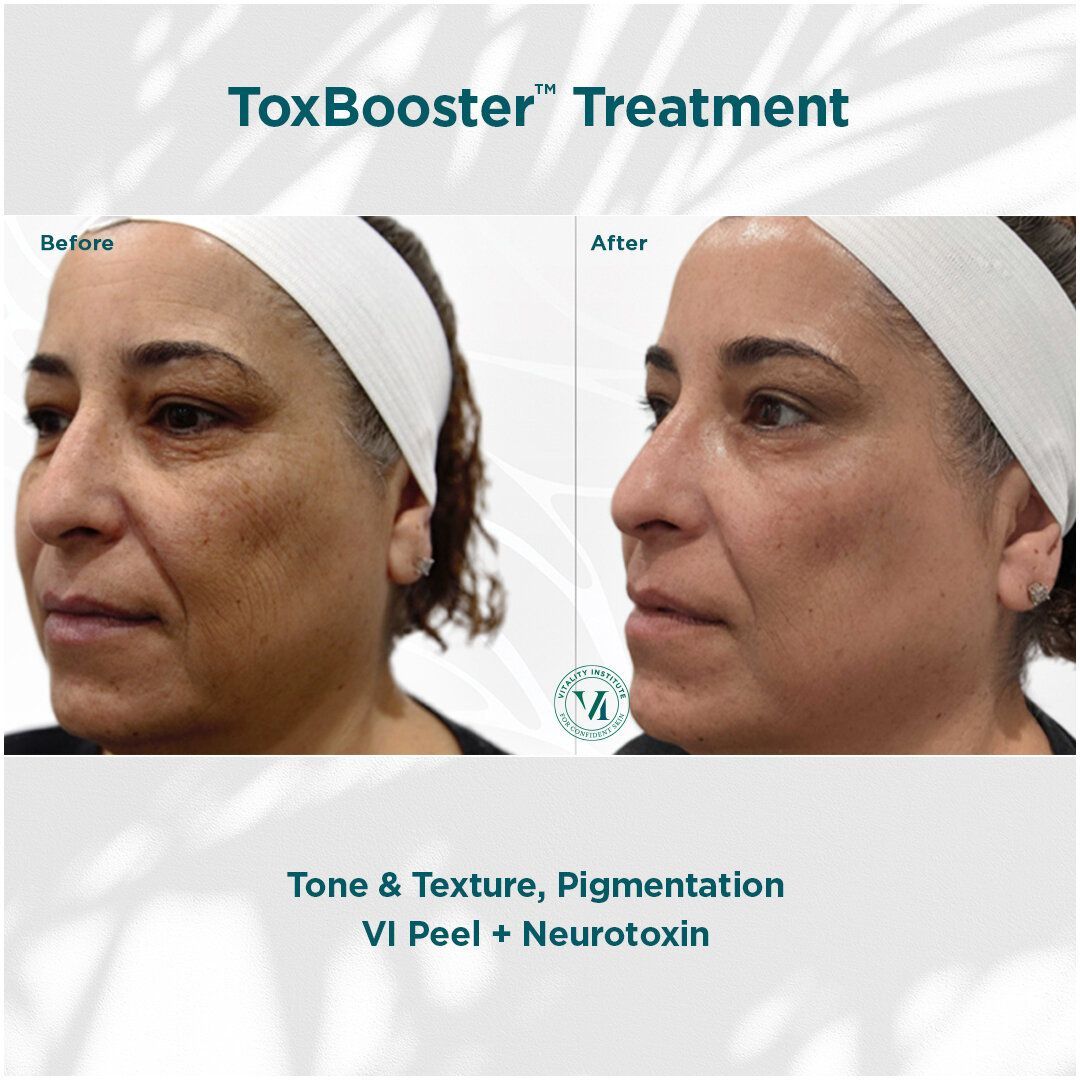 A before and after photo of a woman 's face.