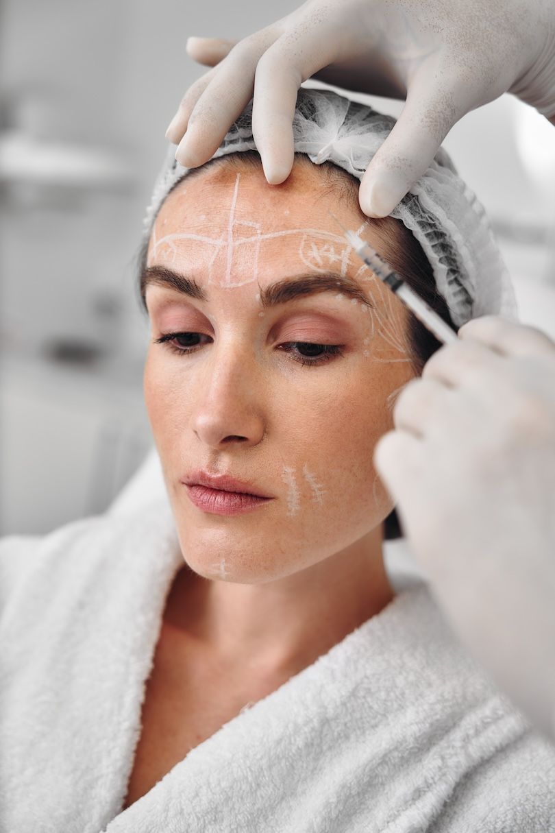 Dermal Fillers Treatments Near Oviedo FL